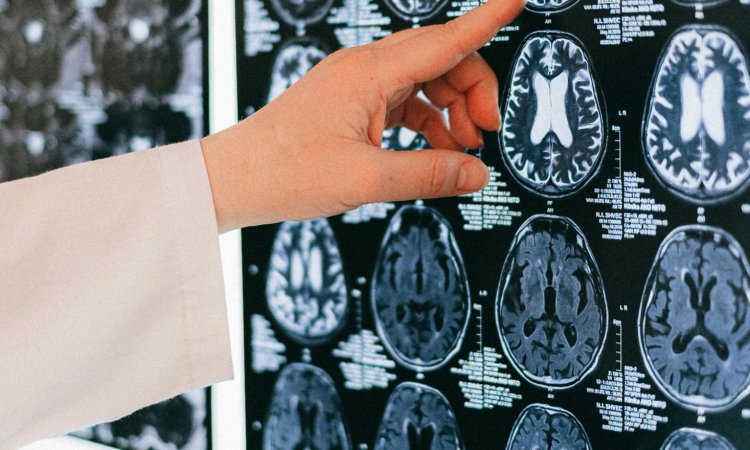 Rehabilitación tras Accidente Cerebrovascular